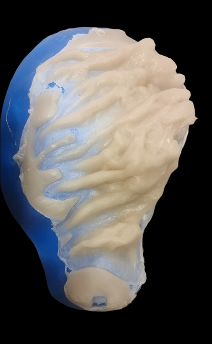 stone-textured silicone ear prosthetics