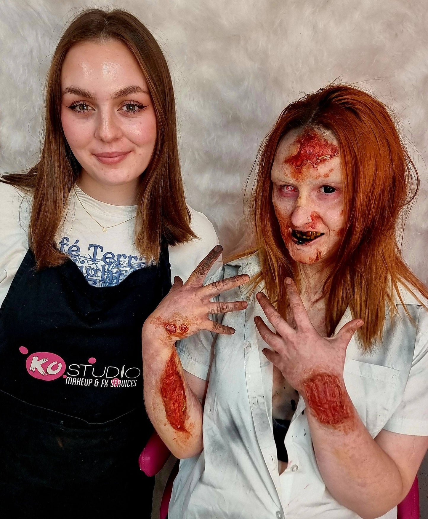 prosthetic, workshop, wounds