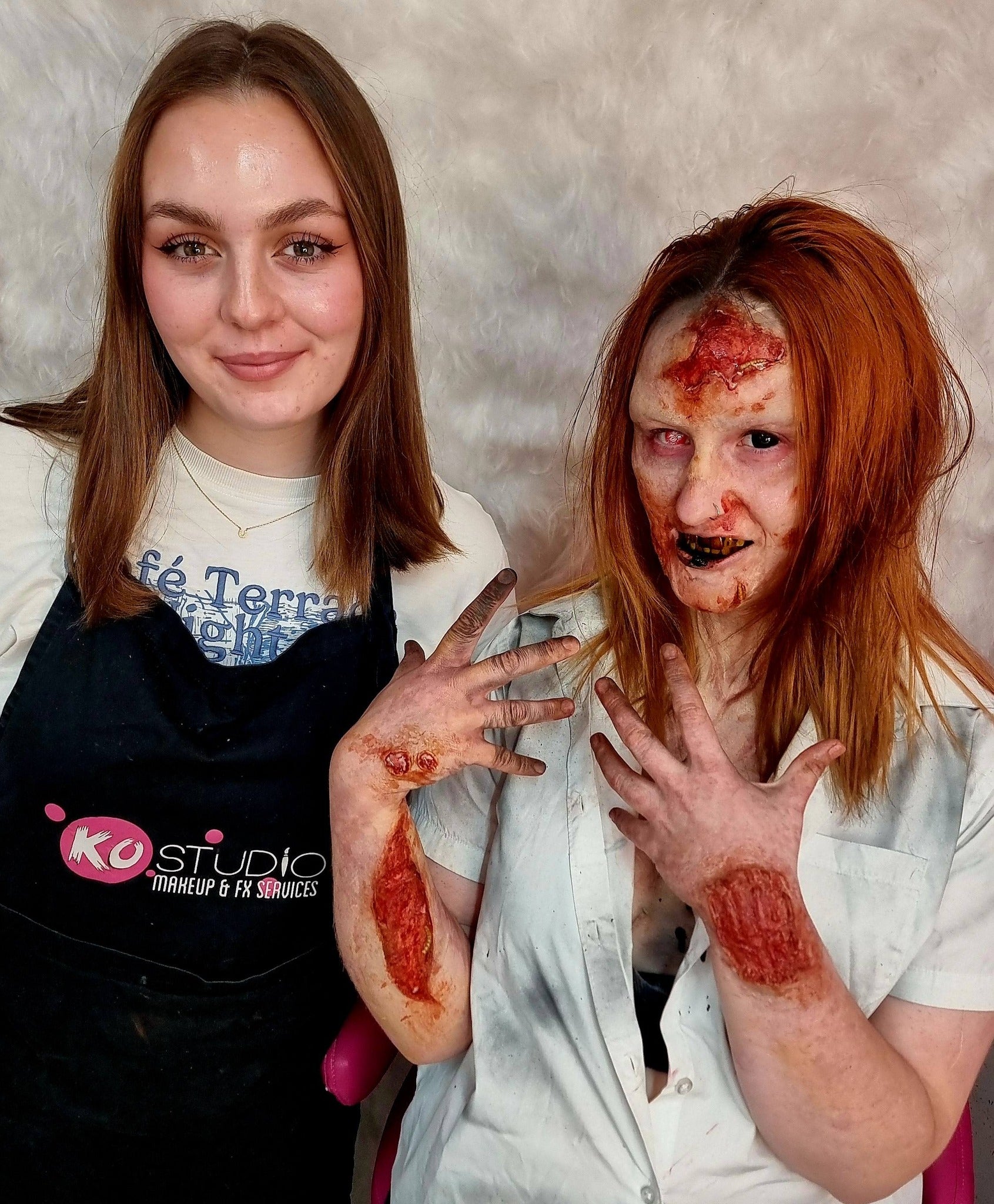 prosthetic, workshop, wounds