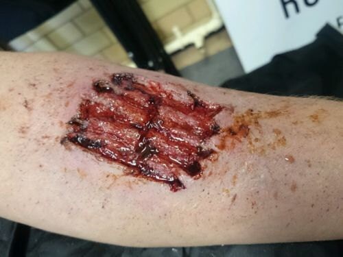 zombie latex bite injury